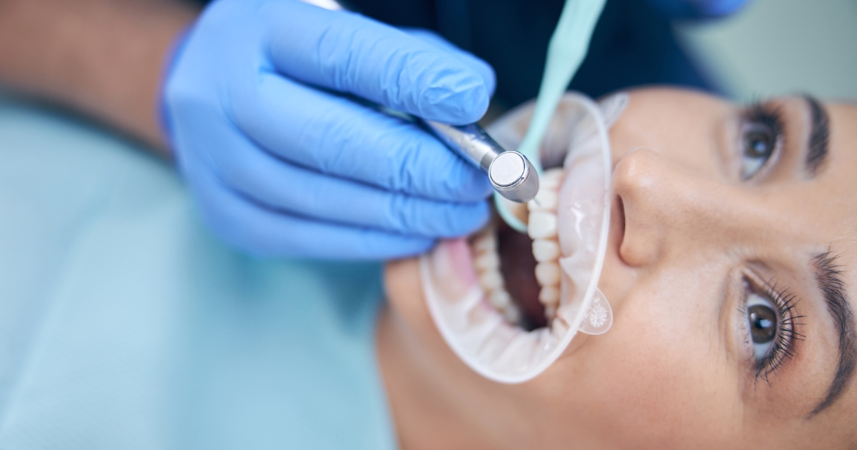 How Do Dental Fillings Work